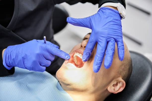 Best 24-Hour Emergency Dentist in Burtonsville, MD