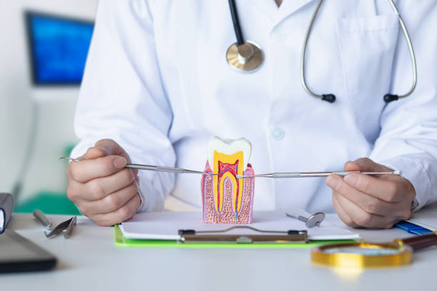 Best Emergency Root Canal Treatment in Burtonsville, MD